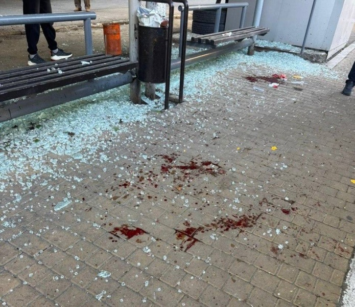 Под удар в Одессе попала остановка транспорта с людьми (фото)